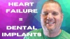 A Dental Implant Story: Stage 4 Heart Failure Patient Gets A New Smile