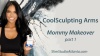 CoolSculpting the Arms, Mommy Makeover Video