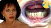A Dental Implant Story - Dentures Are So Depressing