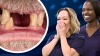 A Dental Implant Story - The Most Amazing Thing A Doctor Ever Did For A Veteran