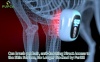 Show in main carousel: PUPCA Cold Laser Red Light Therapy Brush for Dogs & Cats, Blue slide 11 of 11