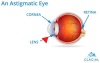 An Astigmatic Eye
