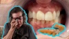 A Dental Imaplant Story - Her Dentures Were So Annoying