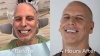 A Dental Implant Story - After 35 Years Adam Finally Got A New Smile
